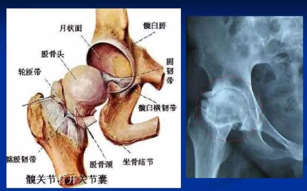 济和堂中医门诊部：股骨头的病因是什么你知道吗？